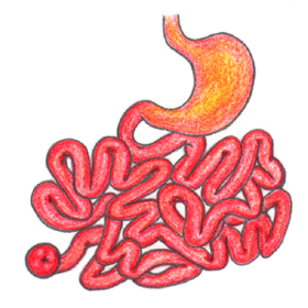 회장루 (回腸瘻 : ileostomy) 이미지